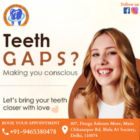 Teeth Gaps Treatment at Target Dental Hospital, Chhatarpur, South Delhi